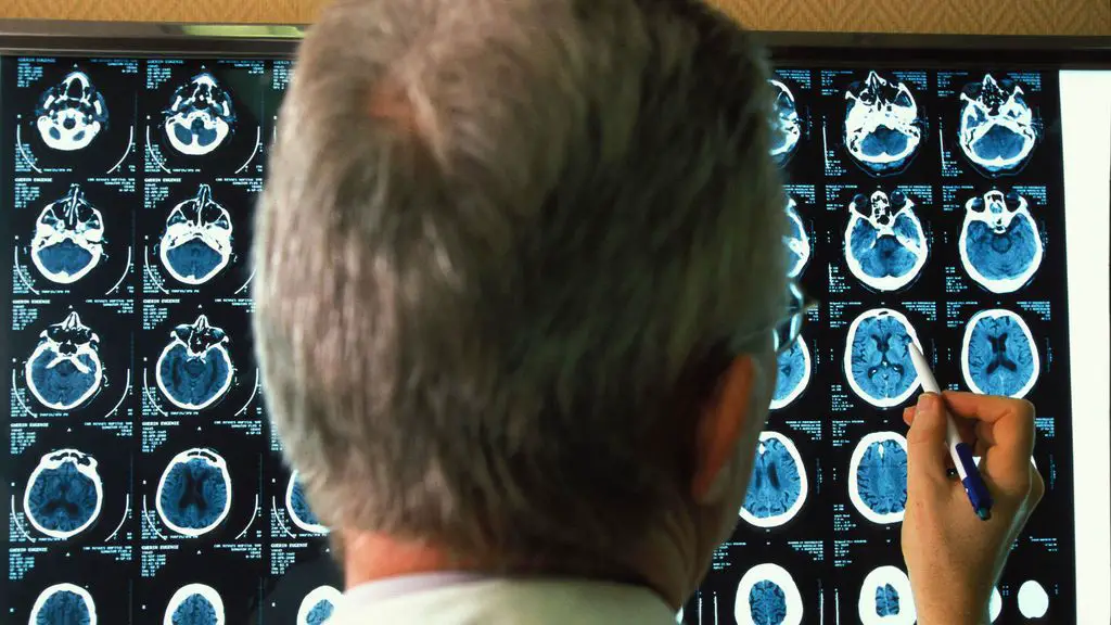ultrasonido para tratar el Alzheimer