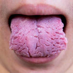color lengua salud